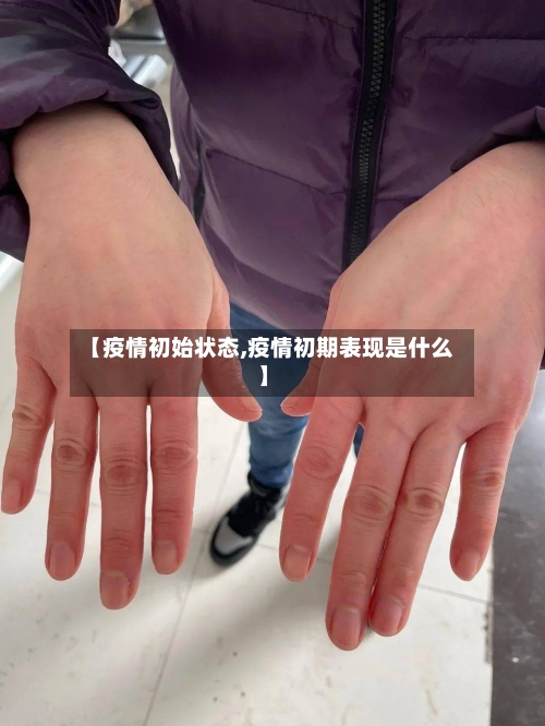 【疫情初始状态,疫情初期表现是什么】