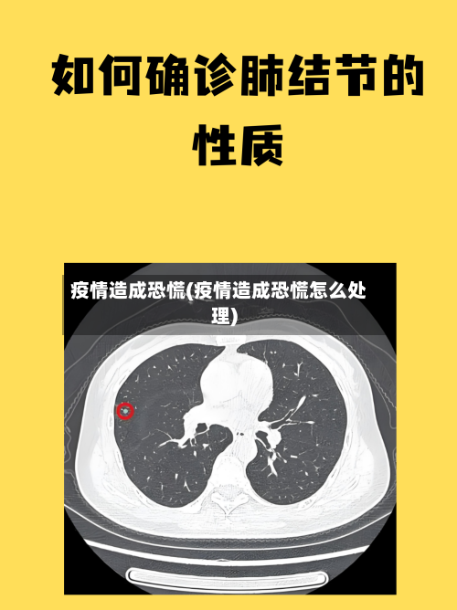 疫情造成恐慌(疫情造成恐慌怎么处理)-第3张图片