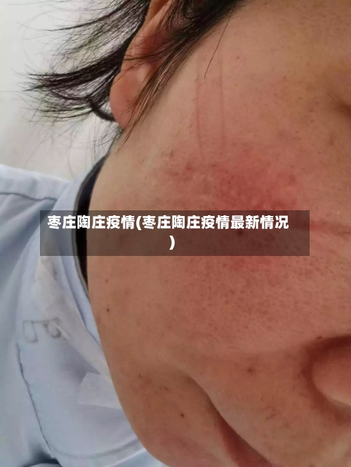 枣庄陶庄疫情(枣庄陶庄疫情最新情况)